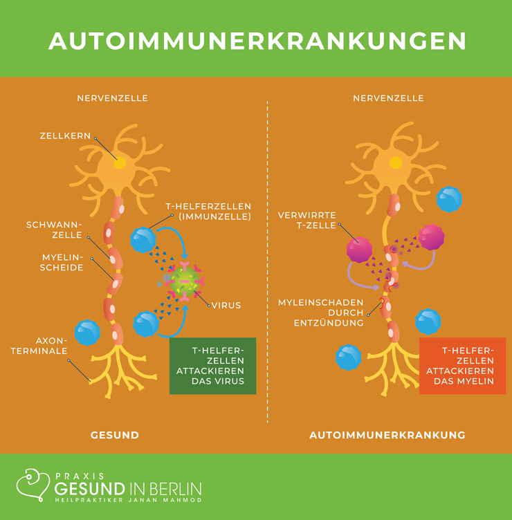 Autoimmunerkrankungen - Naturheilpraxis Gesund in Berlin