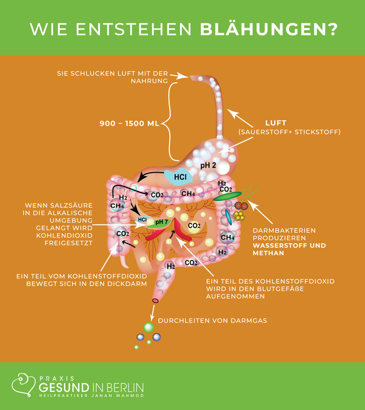 Blähungen – Schaubild Blähungen – Schaubild