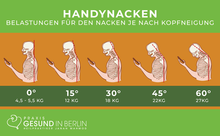 Handynacken – Nackenschmerzen Handynacken – Nackenschmerzen