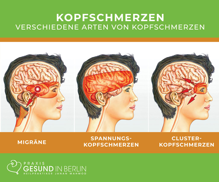 Nackenschmerzen – Naturheilpraxis Gesund in Berlin