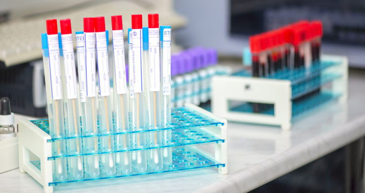 Speichelanalysen für die Labordiagnostik Bild von Speichelanalysen für die Labordiagnostik