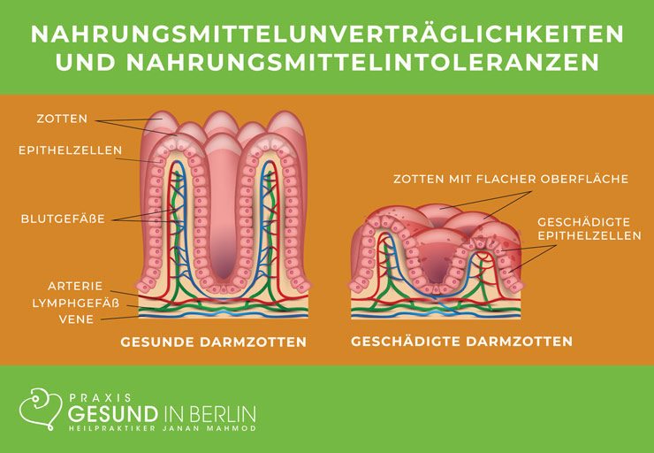Nahrungsmittelunverträglichkeiten und Nahrungsmittelintoleranzen