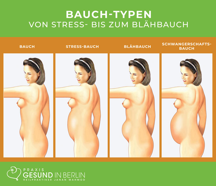 Reizdarm – Bauch-Typen