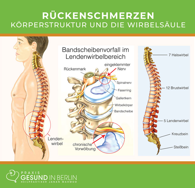 Rückenschmerzen – Körperstruktur und die Wirbelsäule