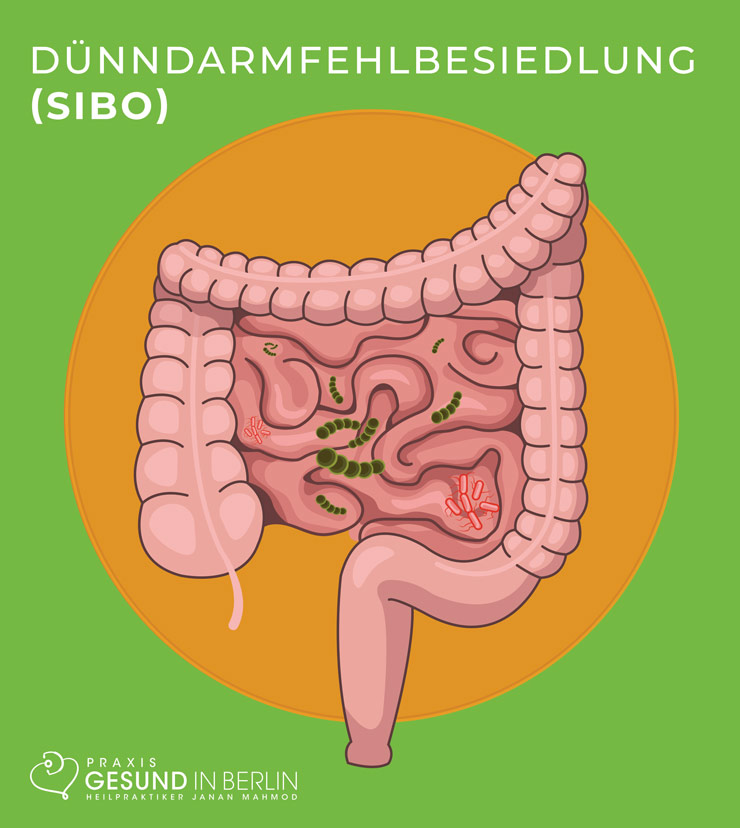 Bakterien bei einer SIBO – Dünndarmfehlbesiedlung
