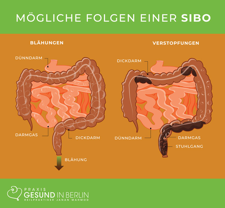 Aufgeblähter bauch morgens Blähungen