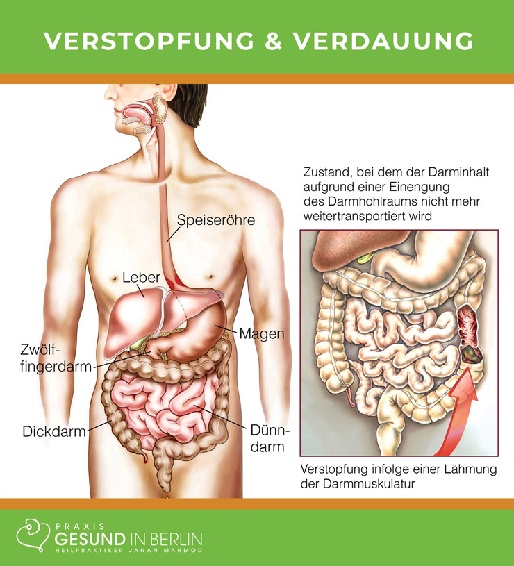 Verstopfung & Verdauung – Schaubild